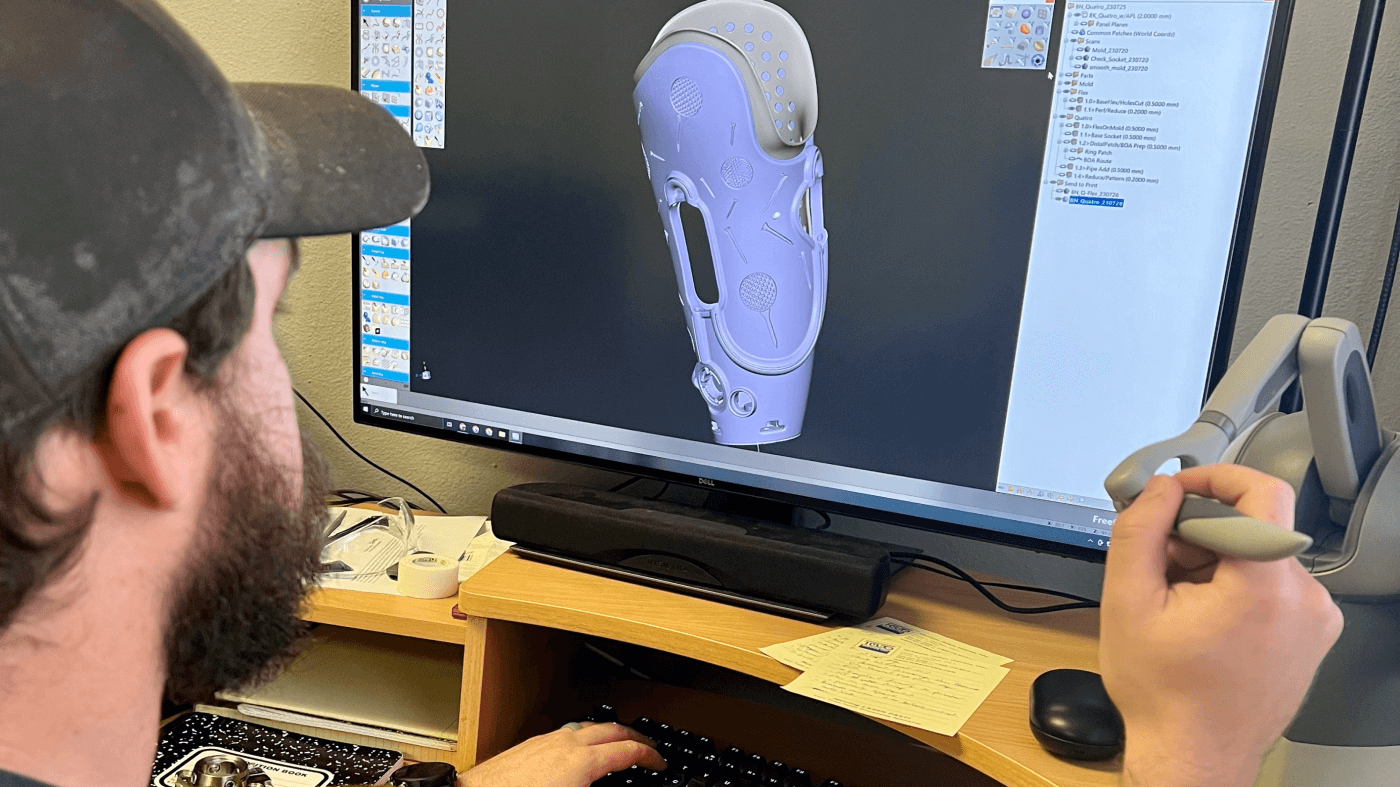 Quorum Prosthetics使用  Freeform设计其具有专利设计的3D打印接受腔Quatro